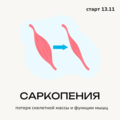 Саркопения 