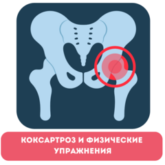 Как движения помогают при коксартрозе