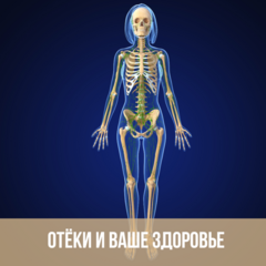 Отёки и ваше здоровье
