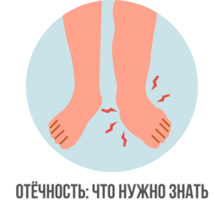 Отёчность: что нужно знать каждому